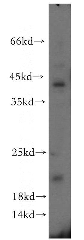 PC-3 cells were subjected to SDS PAGE followed by western blot with Catalog No:111946(ITGB1BP1 antibody) at dilution of 1:300