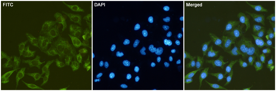 Immunofluorescent analysis of HeLa cells fixed with -20℃ Methanol and using Cytokeratin (Pan) Mouse mAb (168518,dilution 1:500,green). DAPI was used to stain nucleus(blue).