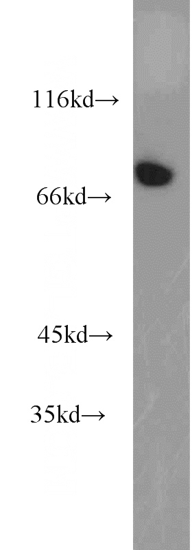 HepG2 cells were subjected to SDS PAGE followed by western blot with Catalog No:107990(AMFR antibody) at dilution of 1:800