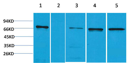 Fig1:; Western blot analysis of 1) Hela, 2) Jurkat, 3) Mouse Brain, 4) Mouse Kidney, 5) Rat Brain using ZBTB45 Polyclonal Antibody.. Secondary antibody（catalog#: HA1001) was diluted at 1:20000