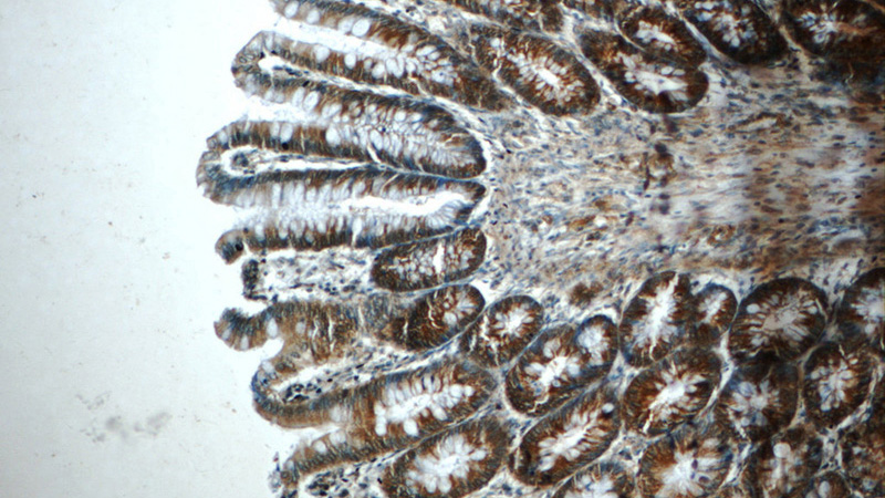 Immunohistochemistry of paraffin-embedded human colon tissue slide using Catalog No:110677(FKBP52 Antibody) at dilution of 1:50 (under 10x lens)