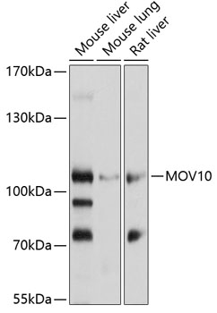 Western blot - MOV10 Polyclonal Antibody 