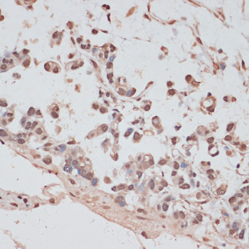 Immunohistochemistry - PRPF31 Polyclonal Antibody 