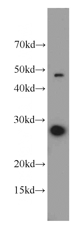 MCF7 cells were subjected to SDS PAGE followed by western blot with Catalog No:113762(PDAP1 antibody) at dilution of 1:800