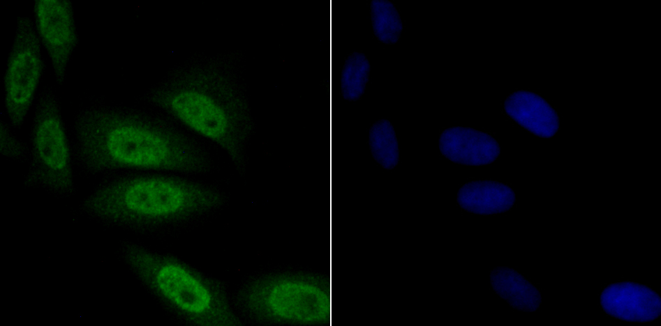 Fig4:; ICC staining of TNPO3 in SiHa cells (green). Formalin fixed cells were permeabilized with 0.1% Triton X-100 in TBS for 10 minutes at room temperature and blocked with 1% Blocker BSA for 15 minutes at room temperature. Cells were probed with the primary antibody ( 1/50) for 1 hour at room temperature, washed with PBS. Alexa Fluor®488 Goat anti-Rabbit IgG was used as the secondary antibody at 1/1,000 dilution. The nuclear counter stain is DAPI (blue).