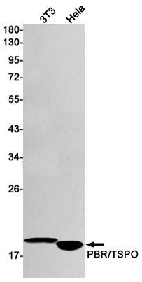 Western blot detection of PBR/TSPO in 3T3,Hela cell lysates using PBR/TSPO Rabbit mAb(1:1000 diluted).Predicted band size:19kDa.Observed band size:19kDa.
