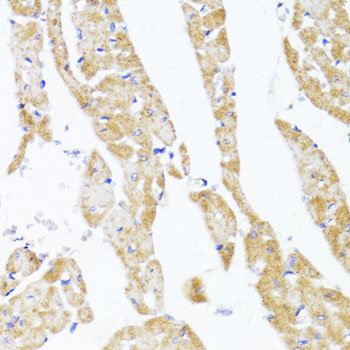 Immunohistochemistry - EGLN1/EGLN2 Polyclonal Antibody 