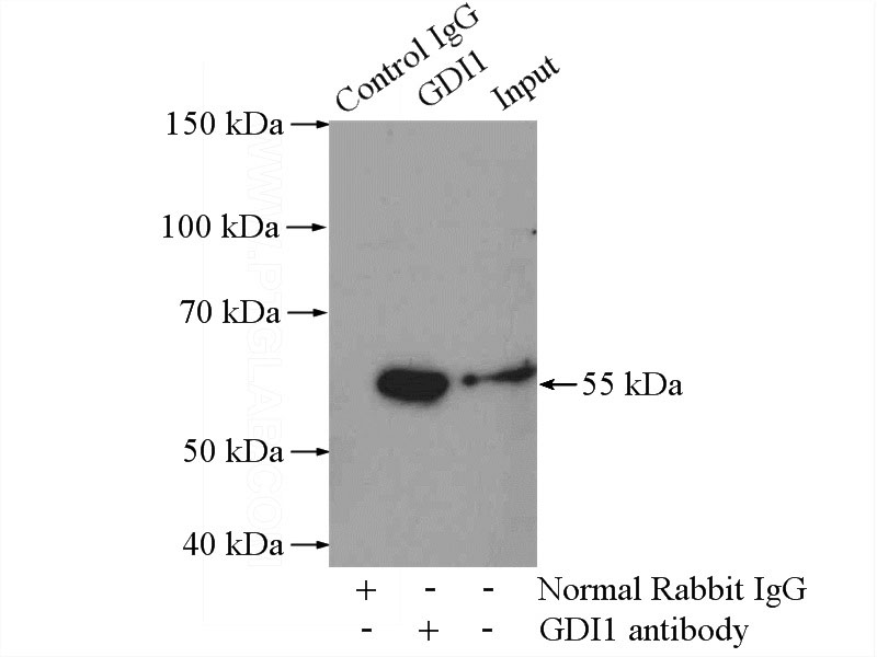 IP Result of anti-GDI1 (IP:Catalog No:110925, 4ug; Detection:Catalog No:110925 1:800) with mouse brain tissue lysate 4000ug.