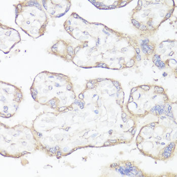 Immunohistochemistry - KL Polyclonal Antibody 