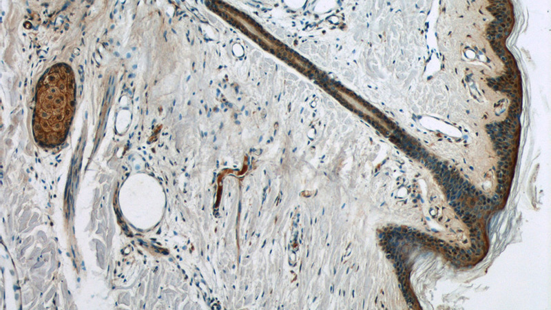 Immunohistochemistry of paraffin-embedded human skin tissue slide using Catalog No:110004(DMKN Antibody) at dilution of 1:50 (under 10x lens)