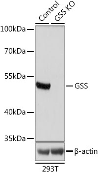 Western blot - GSS Polyclonal Antibody 