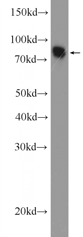 mouse brain tissue were subjected to SDS PAGE followed by western blot with Catalog No:112789(MTMR7 Antibody) at dilution of 1:600