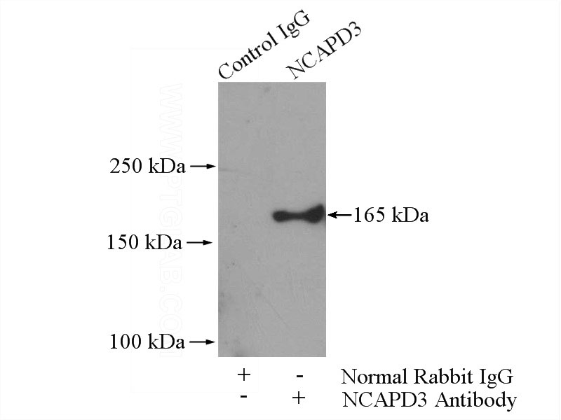 IP Result of anti-NCAPD3 (IP:Catalog No:113030, 4ug; Detection:Catalog No:113030 1:500) with HeLa cells lysate 600ug.
