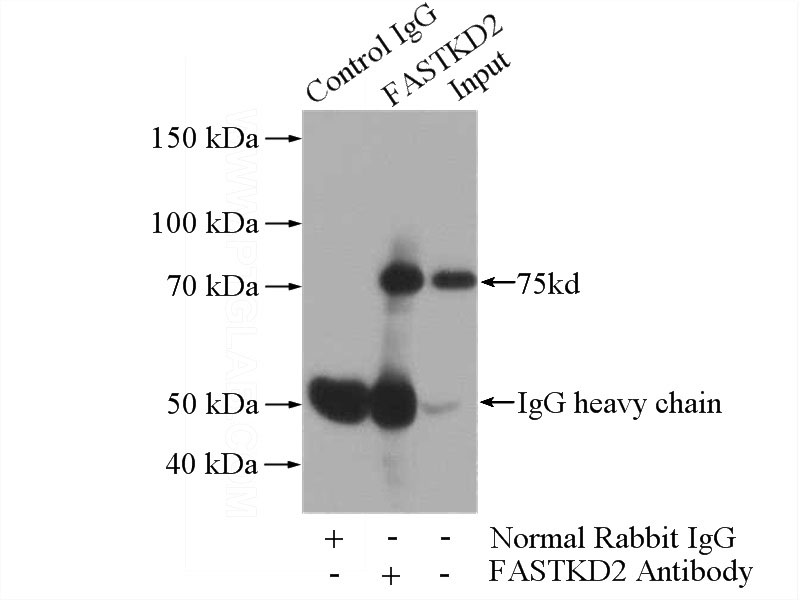 IP Result of anti-FASTKD2 (IP:Catalog No:110530, 4ug; Detection:Catalog No:110530 1:300) with mouse heart tissue lysate 4000ug.