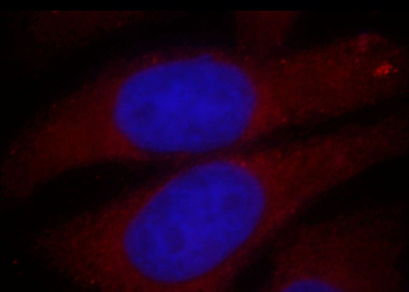 Immunofluorescent analysis of HepG2 cells, using ZFYVE9 antibody Catalog No:115068 at 1:25 dilution and Rhodamine-labeled goat anti-rabbit IgG (red). Blue pseudocolor = DAPI (fluorescent DNA dye).