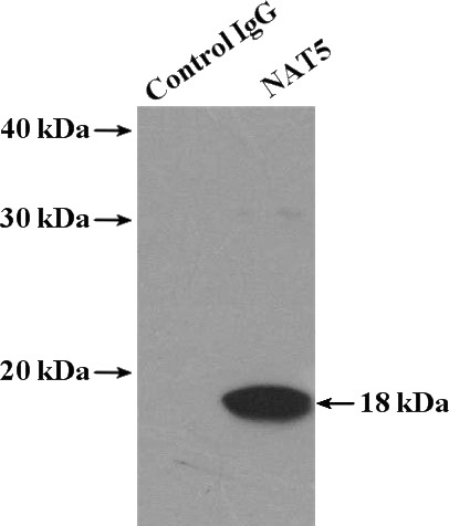 IP Result of anti-NAT5 (IP:Catalog No:112963, 4ug; Detection:Catalog No:112963 1:500) with HL-60 cells lysate 3040ug.