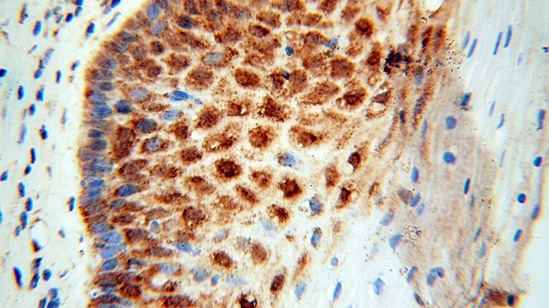 Immunohistochemical of paraffin-embedded human cervix using Catalog No:109925(DHRS4 antibody) at dilution of 1:100 (under 40x lens)