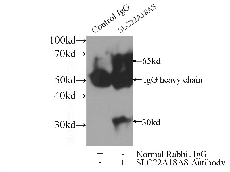 IP Result of anti-SLC22A18AS (IP:Catalog No:115315, 3ug; Detection:Catalog No:115315 1:300) with HepG2 cells lysate 3600ug.