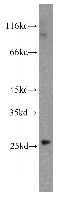human testis tissue were subjected to SDS PAGE followed by western blot with Catalog No:113726(PEX11G antibody) at dilution of 1:500
