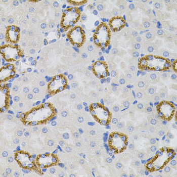 Immunohistochemistry - SIGMAR1 Polyclonal Antibody 