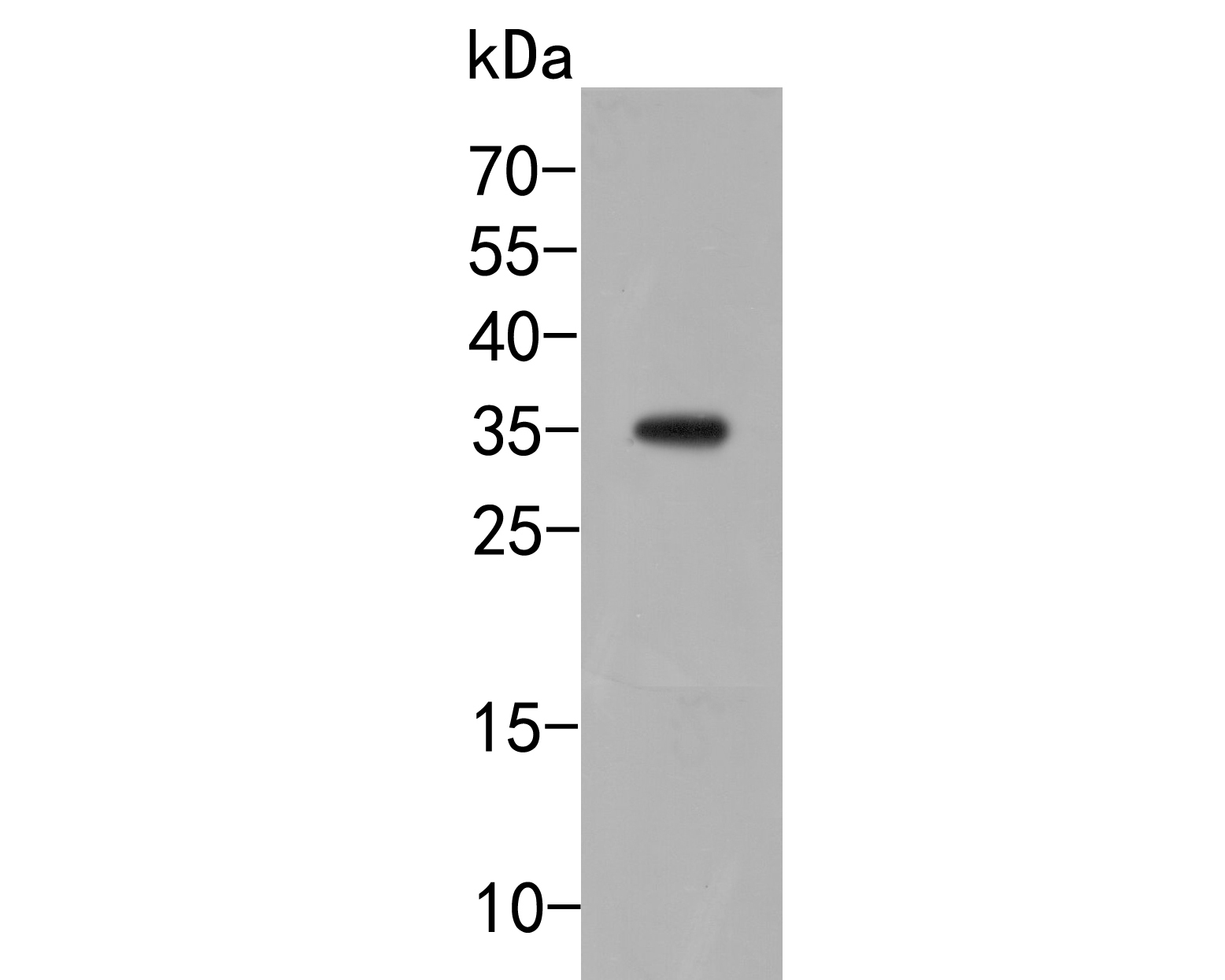 Fig1:; Western blot analysis of TMEM119 on SHSY5Y cell lysate. Proteins were transferred to a PVDF membrane and blocked with 5% BSA in PBS for 1 hour at room temperature. The primary antibody ( 1/500) was used in 5% BSA at room temperature for 2 hours. Goat Anti-Rabbit IgG - HRP Secondary Antibody (HA1001) at 1:5,000 dilution was used for 1 hour at room temperature.