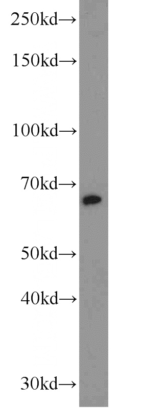 PC-3 cells were subjected to SDS PAGE followed by western blot with Catalog No:115536(SPAG8 antibody) at dilution of 1:1000