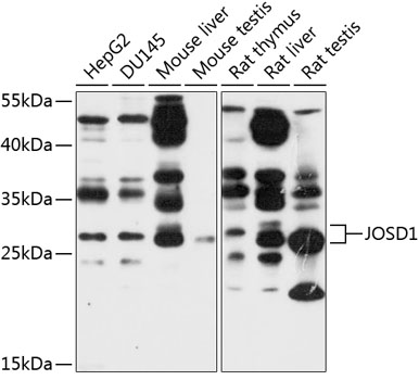 Western blot - JOSD1 Polyclonal Antibody 