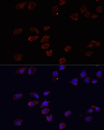 Immunofluorescence - ARF6 Polyclonal Antibody 