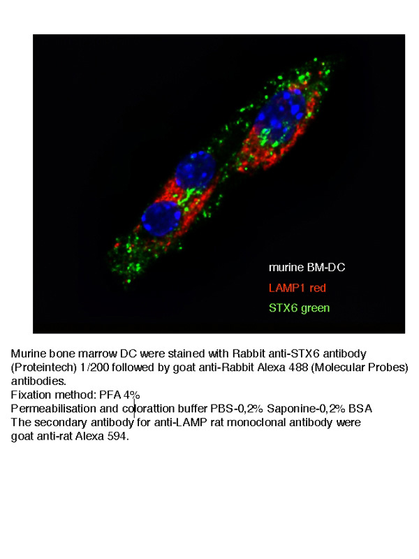 IF result of anti-STX6(Catalog No:115799) in Murine BM-DC by Dr. LOREDANA SAVEANU.