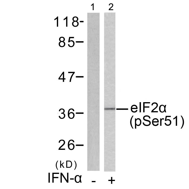 Western blot analysis of extracts from Jurkat cells untreated or treated with H2O2 using eIF2u03b1 (Phospho-Ser51) Antibody .