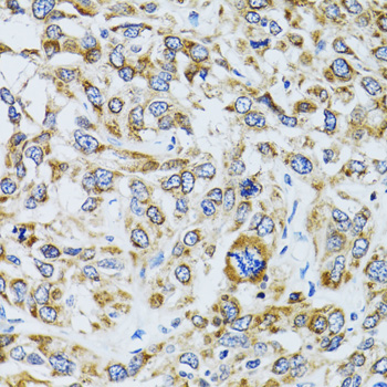 Immunohistochemistry - RPN1 Polyclonal Antibody 