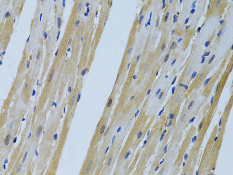 Immunohistochemistry - FHL2 Polyclonal Antibody 