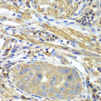 Immunohistochemistry - PICK1 Polyclonal Antibody 
