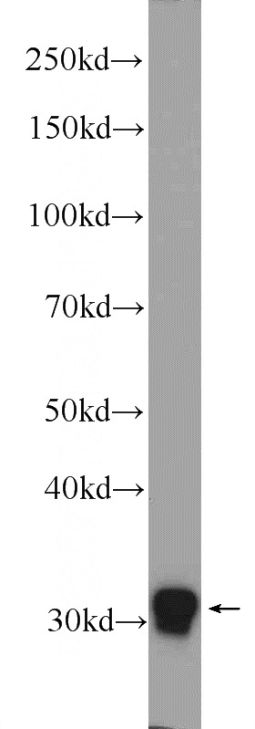 MCF-7 cells were subjected to SDS PAGE followed by western blot with Catalog No:110744(FOSL2 Antibody) at dilution of 1:300