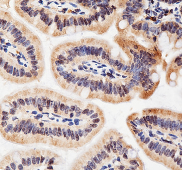 Immunohistochemistry - ACHE Polyclonal Antibody 