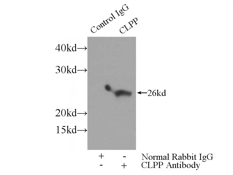IP Result of anti-CLPP (IP:Catalog No:109401, 3ug; Detection:Catalog No:109401 1:500) with mouse skeletal muscle tissue lysate 4000ug.