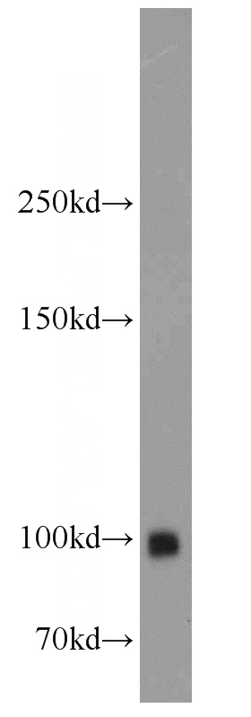 mouse kidney tissue were subjected to SDS PAGE followed by western blot with Catalog No:112694(MME,CD10 antibody) at dilution of 1:1000