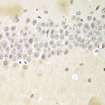 Immunohistochemistry - NONO Polyclonal Antibody 