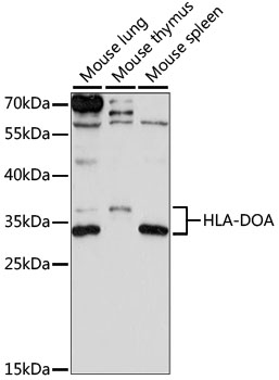 Western blot - HLA-DOA Polyclonal Antibody 