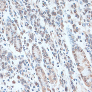 Immunohistochemistry - ZNF707 Polyclonal Antibody 