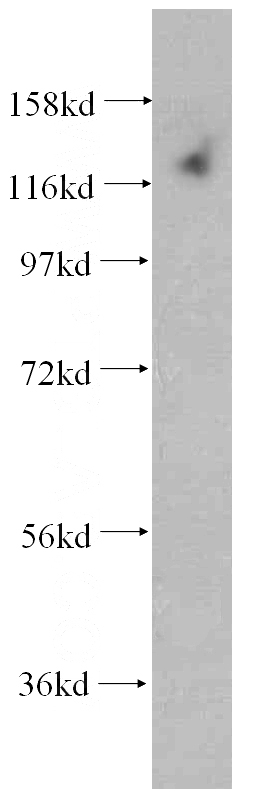 human heart tissue were subjected to SDS PAGE followed by western blot with Catalog No:109818(DAAM1 antibody) at dilution of 1:500