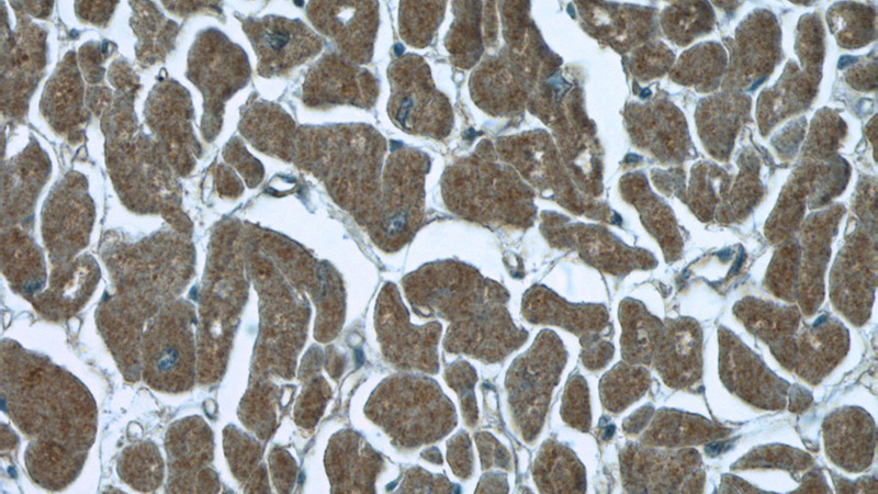 Immunohistochemistry of paraffin-embedded human heart tissue slide using Catalog No:111756(ILVBL Antibody) at dilution of 1:100 (under 40x lens)