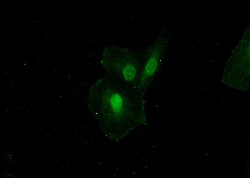 Immunofluorescent analysis of A549 cells using Catalog No:110885(GATAD2B Antibody) at dilution of 1:50 and Alexa Fluor 488-congugated AffiniPure Goat Anti-Rabbit IgG(H+L)