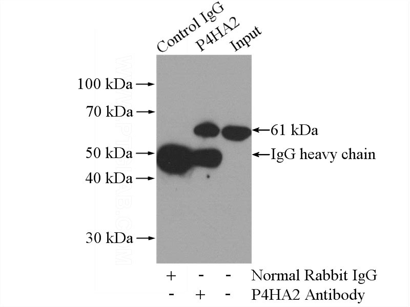 IP Result of anti-P4HA2 (IP:Catalog No:113551, 4ug; Detection:Catalog No:113551 1:1000) with HeLa cells lysate 1200ug.