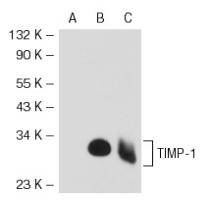 Fig1: Western blot analysis of TIMP-1 expression in non-transfected(A) and human TIMP-1 transfected (B) 293T whole cell lysates and human recombinant TIMP-1 (C).