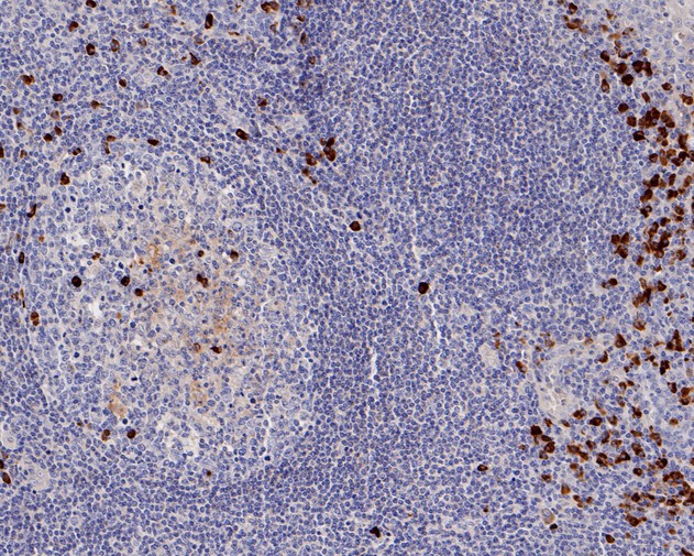 Fig2:; Immunohistochemical analysis of paraffin-embedded human tonsil tissue using anti-Human Kappa light chain antibody. The section was pre-treated using heat mediated antigen retrieval with Tris-EDTA buffer (pH 8.0-8.4) for 20 minutes.The tissues were blocked in 5% BSA for 30 minutes at room temperature, washed with ddH; 2; O and PBS, and then probed with the primary antibody ( 1/50) for 30 minutes at room temperature. The detection was performed using an HRP conjugated compact polymer system. DAB was used as the chromogen. Tissues were counterstained with hematoxylin and mounted with DPX.