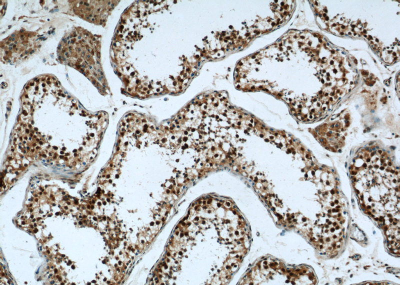 Immunohistochemistry of paraffin-embedded human testis tissue slide using Catalog No:109540(CRCP Antibody) at dilution of 1:50 (under 10x lens)