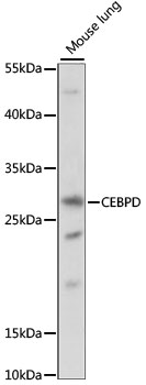 Western blot - CEBPD Polyclonal Antibody 