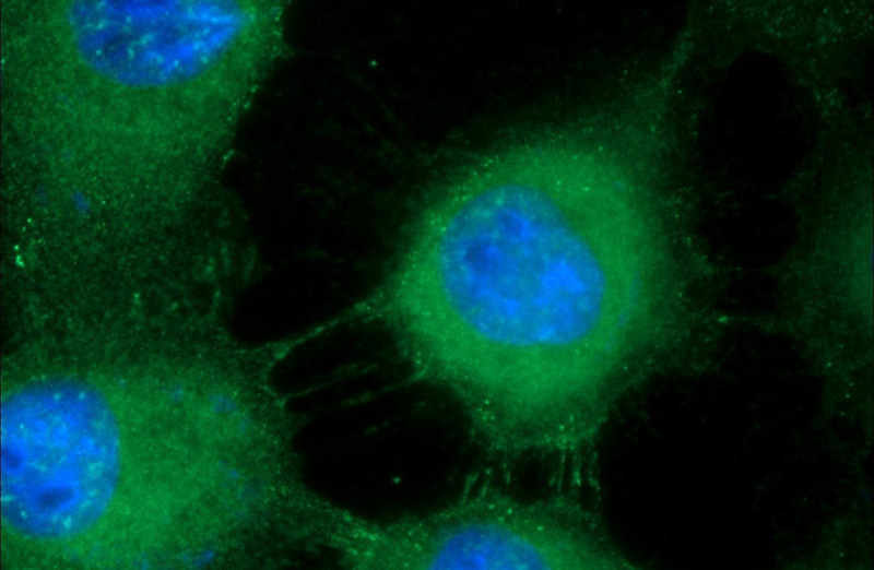 Immunofluorescent analysis of A431 cells using Catalog No:110026(DSG1 Antibody) at dilution of 1:25 and Alexa Fluor 488-congugated AffiniPure Goat Anti-Rabbit IgG(H+L)