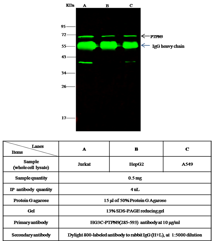 PTPN9 / PTP-MEG2 Antibody, Rabbit PAb, Antigen Affinity Purified, Immunoprecipitation